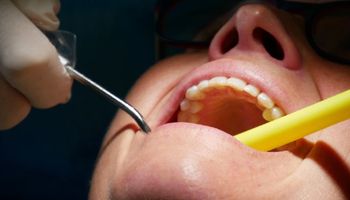 Zdarza ci się zgrzytać zębami i zaciskać szczękę? Nawyk jest szkodliwy i warto się go pozbyć