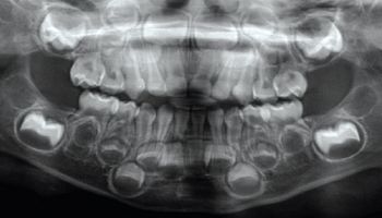 Czy zęby to kości? Skąd się biorą i z czego właściwie są zbudowane?