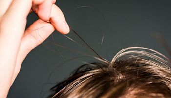 Czym jest trichotillomania, czyli kompulsywne wyrywanie włosów? Chorzy często nie szukają pomocy