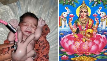 Dziecko urodzone z czterema nogami i rękami utożsamiane jest z hinduską boginią