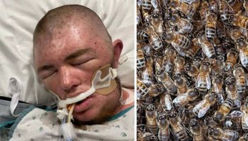 20-latek został użądlony ponad 20000 razy przez afrykańskie pszczoły zabójcy