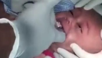 Dziecko przestało oddychać i było sine, gdy trafiło do szpitala. Lekarze wyciągnęli z jego gardła…