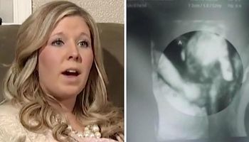 Kobieta była w ciąży z bliźniakami. Kiedy lekarz pokazał jej jedno ze zdjęć USG była poruszona