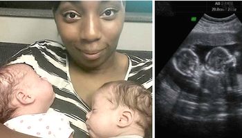 W ciągu zaledwie 2 lat, ta kobieta zaszła 3 razy w ciążę bliźniaczą! Sami lekarze są w szoku