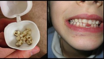 Lekarze apelują, aby nie wyrzucać zębów mlecznych dzieci. Mogą później uratować życie