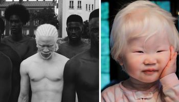 15 osób z albinizmem, które hipnotyzują swoim nieziemskim pięknem. Są jedyni w swoim rodzaju!