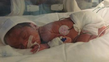 Ich dziecko zmarło tuż po urodzeniu. 10 miesięcy później fotograf robi zdjęcie, które po prostu musisz zobaczyć