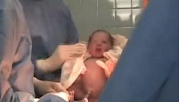 To, co zrobił ten noworodek kilka minut po przyjściu na świat, wprawiło w osłupienie nawet lekarzy