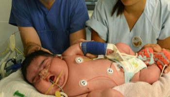 10-kilogramowy noworodek przyszedł na świat w Niemczech. To jedno z największych dzieci na świecie