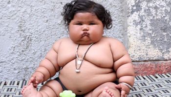 Ta 8-miesięczna dziewczynka waży prawie 18 kilogramów. Lekarze nie mają pojęcia, co jej dolega