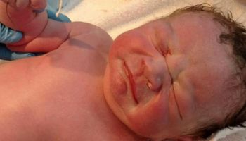 Dziecko urodziło się z przedmiotem w rączce! Lekarze byli tak zaskoczeni, że zrobili mu zdjęcie
