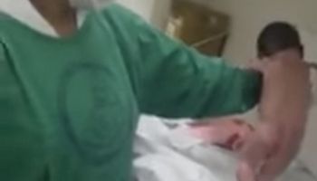 Położna trzymała w dłoni noworodka. Kilka sekund po porodzie dziecko zaczęło iść na własnych nóżkach