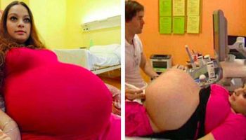 23-latka myśli, że jest w ciąży bliźniaczej. Ale kolejne badanie USG wyprowadza ją z tego błędu!