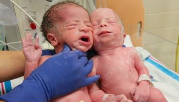 Po tym jak urodziły się bliźniaki, lekarze spojrzeli na ich mamę i nie dowierzali, że to jej dzieci