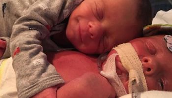11 dniowy noworodek przytula brata bliźniaka. Niestety, wkrótce potem lekarze nie mogą mu już pomóc.