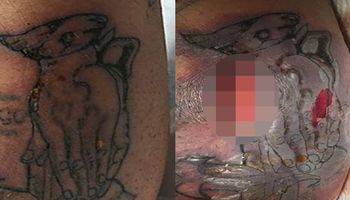 Zdecydował się na tatuaż i nie posłuchał zastrzeżeń artysty. Swoje zachowanie przypłacił życiem.