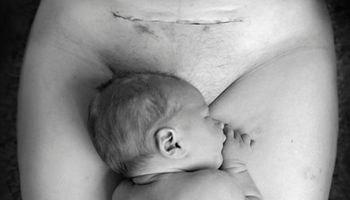 To intymne zdjęcie zrobiono zaraz po porodzie. Tysiące osób skrytykowało je z jednego powodu