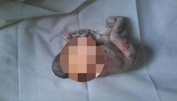 W przenośnej toalecie w Kłobucku znaleziono zwłoki noworodka. Został porzucony zaraz po porodzie