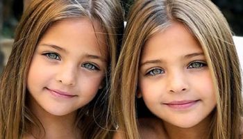 Okrzyknięto je „najpiękniejszymi bliźniaczkami na świecie”. Dziewczynki mają dopiero 7 lat