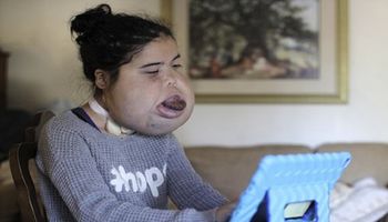 Przez ciężką chorobę nie może mówić i jeść. 16-latka mimo lekarskich diagnoz, nie poddaje się