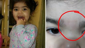 Kiedy odebrała córeczkę z przedszkola zauważyła, że jej brwi wyglądają inaczej niż zwykle
