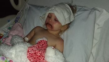 Podzieliła się zdjęciem 3-letniej córki z ranami na buzi. Spowodowała je popularna zabawka