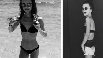 Dziewczyna polskiego projektanta ujawnia swoje zdjęcia z okresu anoreksji. Dziś są już wspomnieniem