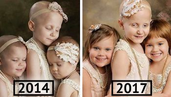 Trzy dziewczynki walczące z rakiem co roku pozują do zdjęcia. Fotografia z 2018 chwyta za serce