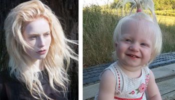 30 osób cierpiących na albinizm. Każda z nich jest na swój sposób wyjątkowa