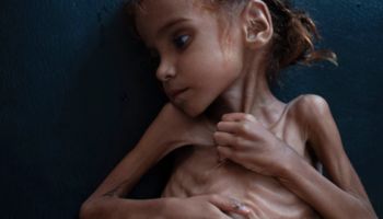 7-letnia dziewczynka zmarła z głodu i wycieńczenia. Jej zdjęcie obiegło cały świat