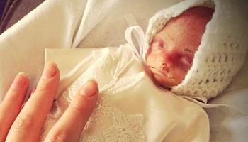 Urodziła się w 22. tygodniu ciąży. Lekarze nie kiwnęli nawet palcem, by ją ratować