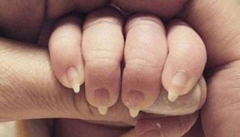 Zamiast obciąć noworodkowi paznokcie, wypiłowała je. 4 absurdalne zachowania rodziców