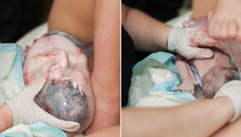 Tak wygląda poród bez cenzury. 25 intymnych i przepełnionych emocjami zdjęć