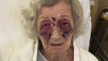 92-latka, która przeżyła Holokaust został pobita w taksówce. „Krew wypływała mi z nosa”