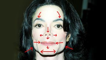 Michael Jackson bez operacji