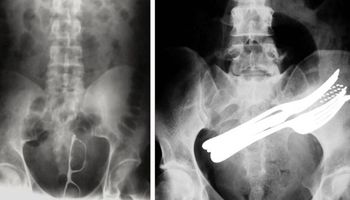 14 zdjęć rentgenowskich, które zdziwiły nawet lekarzy. „Aż mnie boli jak na nie patrzę”