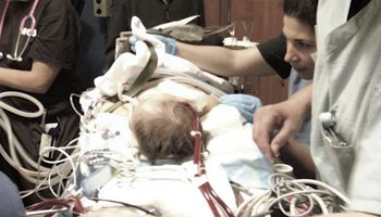 14-miesięczna dziewczynka wypadła z okna. Lekarze przez miesiąc walczyli o jej życie