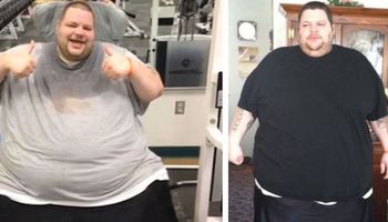 Pokazał, jak wygląda ciało człowieka, który schudł aż 200 kg! Skóra dosłownie na nim wisi