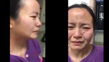 Pielęgniarka pogryziona po twarzy przez pacjentkę