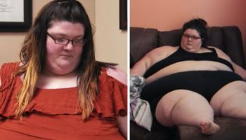 Kobieta ważyła 291 kilogramów. Zmarła po operacji zmniejszania żołądka