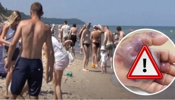 Mięsożerna bakteria w Bałtyku „pożarła” nogę mężczyzny
