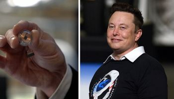 Elon Musk zaprezentował Neuralink. Zabieg wprowadzenia chipu ma trwać tylko 30 minut