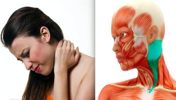 Kręcz szyi – przyczyny, objawy, diagnostyka i leczenie
