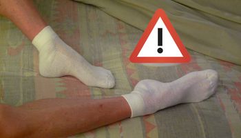 7 objawów zespołu niespokojnych nóg. Syndrom dotyka średnio 1 na 10 osób