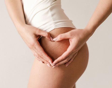 Cellulit wodny – objawy, przyczyny, leczenie, dieta