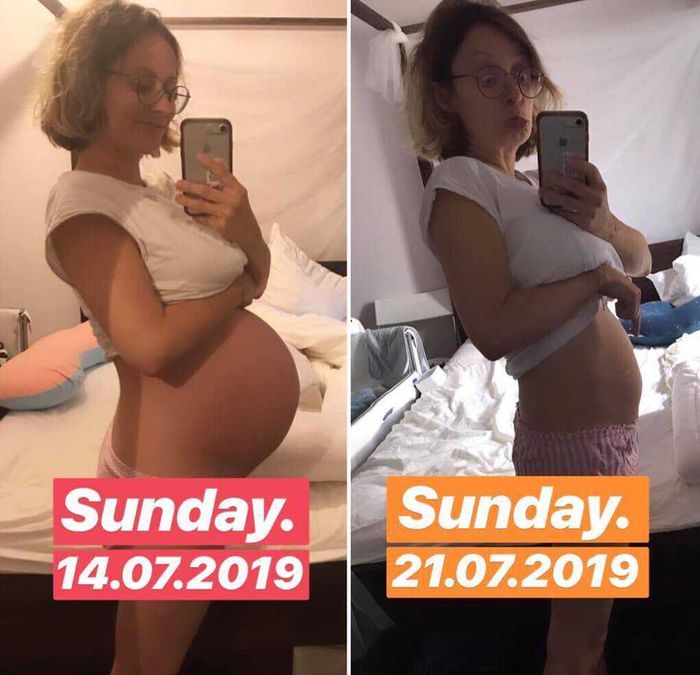 Małgorzata Dec pokazała swój brzuch 5 dni po porodzie