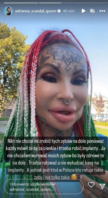 Adrianna Eisenbach kazała spiłować sobie zęby (fot. InstaStories)