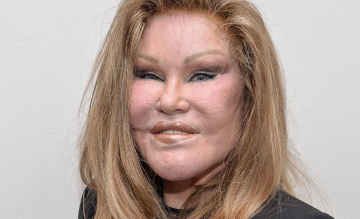 Jocelyn Wildenstein: From classic beauty to pop culture icon