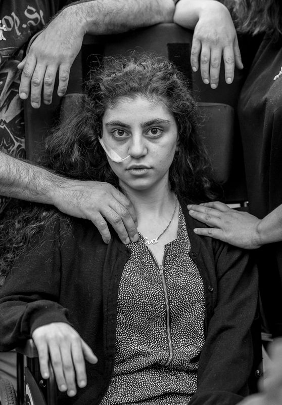 Ewa, 15-letnia Ormianka obudziła się po 8 miesiącach katatonii wywołanej przez syndrom rezygnacji. Siedzi na wózku inwalidzkim otoczona ramionami rodziców. Wciąż grozi im deportacja do Armenii, 1 czerwca 2019
Zdjęcie dominowane do World Press Photo 2020