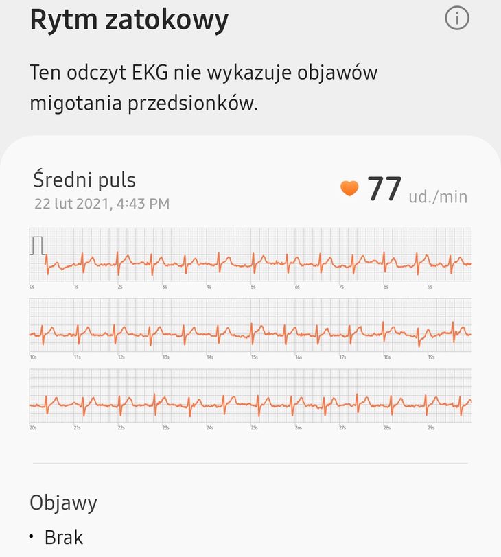 samsung galaxy ecg